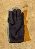 Calling out to its mate--phantom hand syndrome